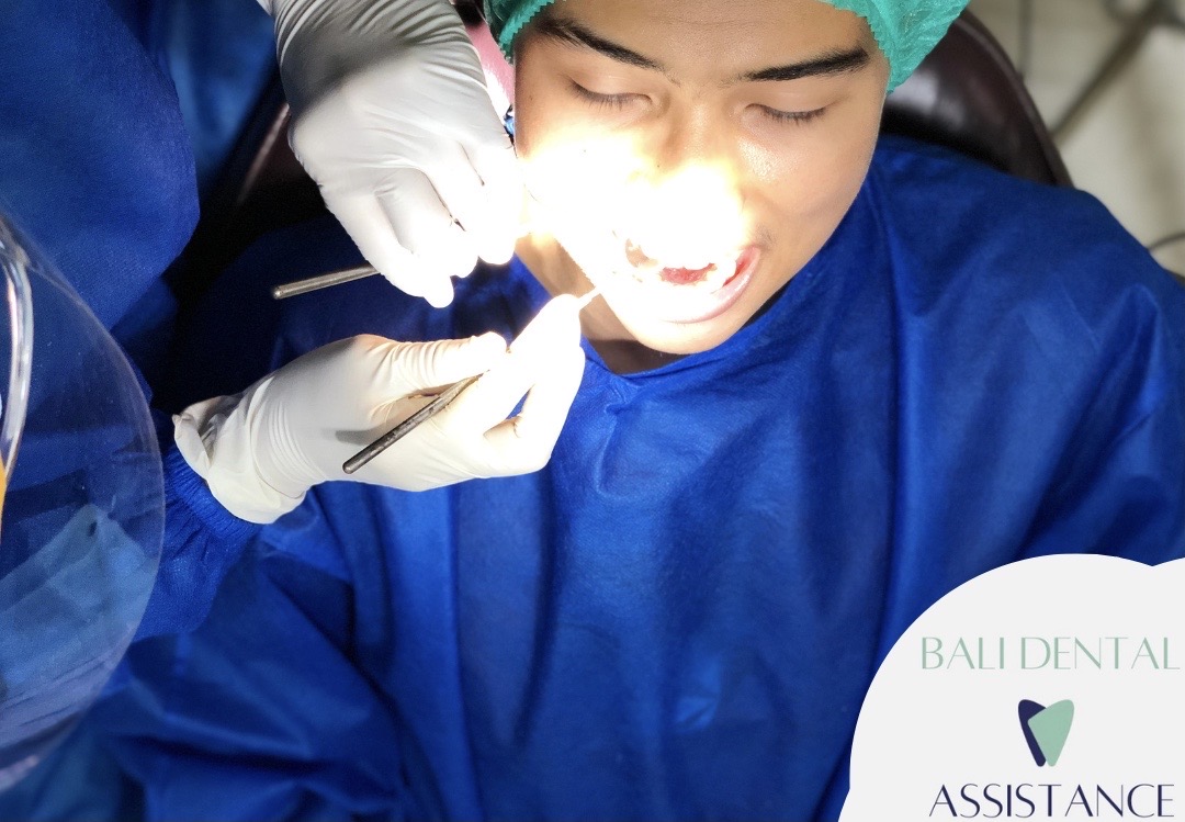 Dentist Operation at Bali Dental Assistance
