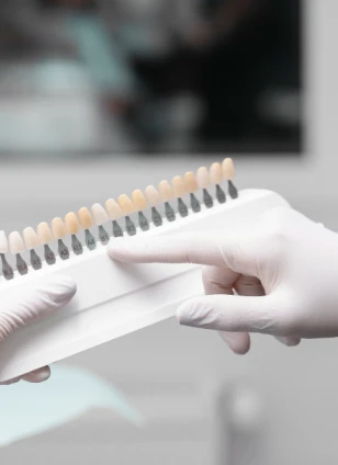 Dental Veneer Bali Dental Assistance