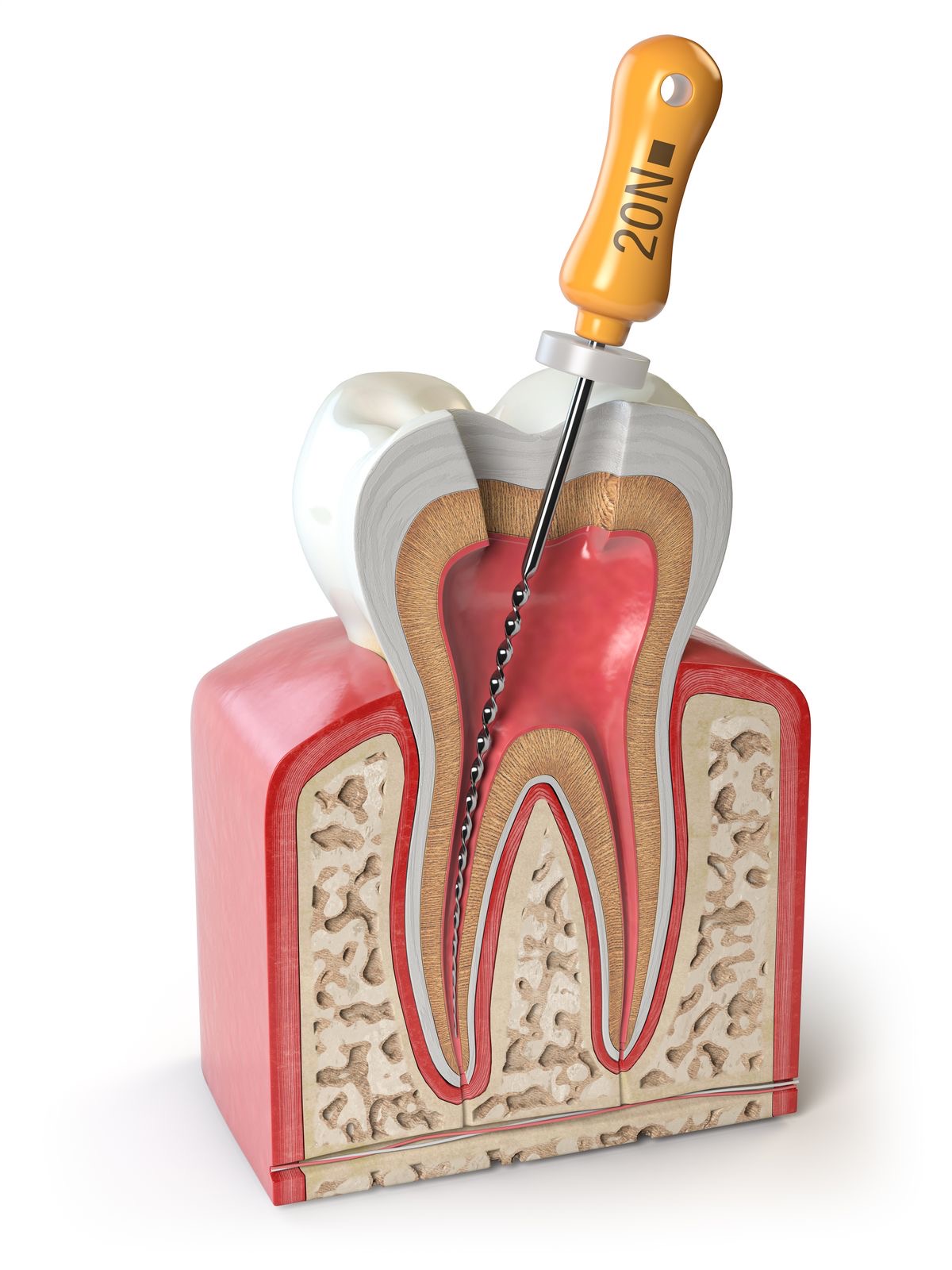 Dental Root Canal Preview in Human HD